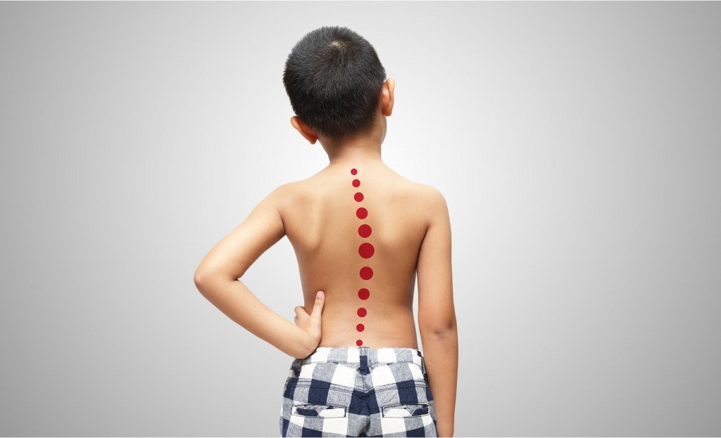 Як сформувати правильну поставу у дітей і підлітків?