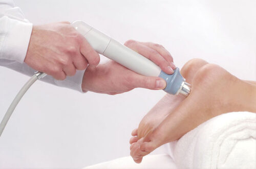 Які сучасні методи лікування п’яткової шпори існують?