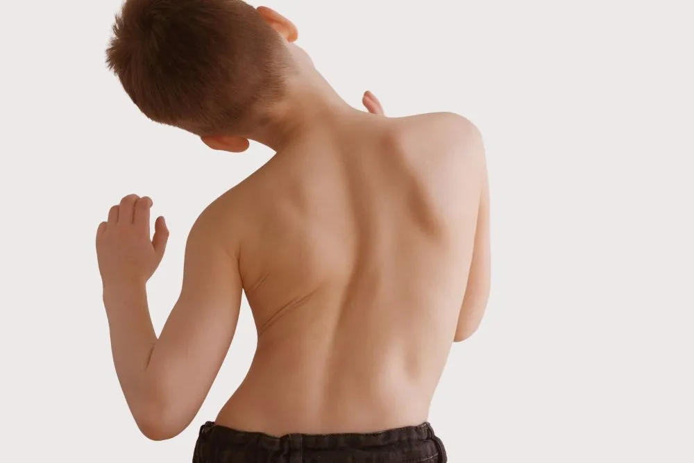 Сколиоз у детей: как вовремя заметить проблему?