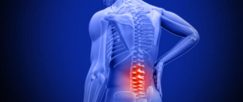 Что делать при грыже поясничного отдела?