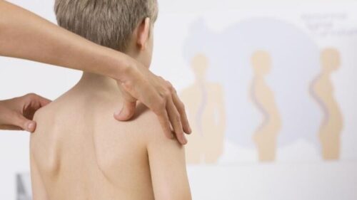 Почему возникает нарушение осанки у детей?