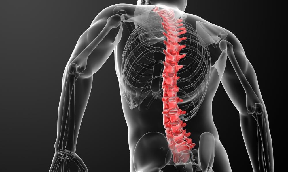 Какие степени сколиоза и как их лечат?